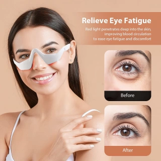 Microcurrent EMS Eye Beauty Massager – Red Light Therapy for Dark Circles & Anti-Aging